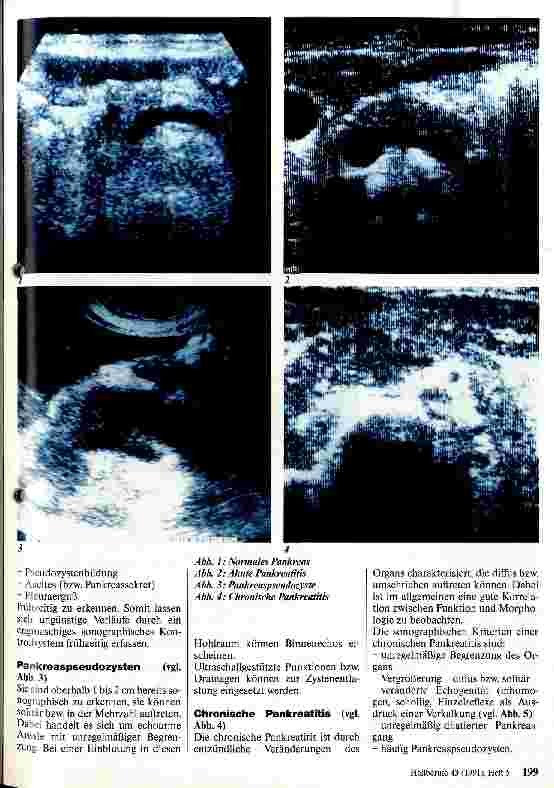 Vorschauseite 2: Sonographische Pankreasdiagnostik - Möglichkeiten und Grenzen