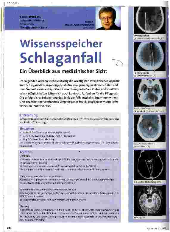 Vorschauseite 1: Wissensspeicher Schlaganfall Ein Überblick aus medizinischer Sicht