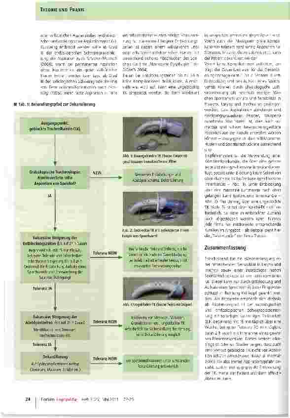 Vorschauseite 3: Dekanülierungsmanagement in der Frührehabilitation
