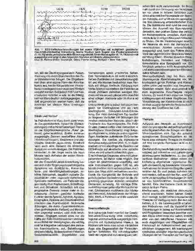 Vorschauseite 3: Slow-Virus-Infektionen