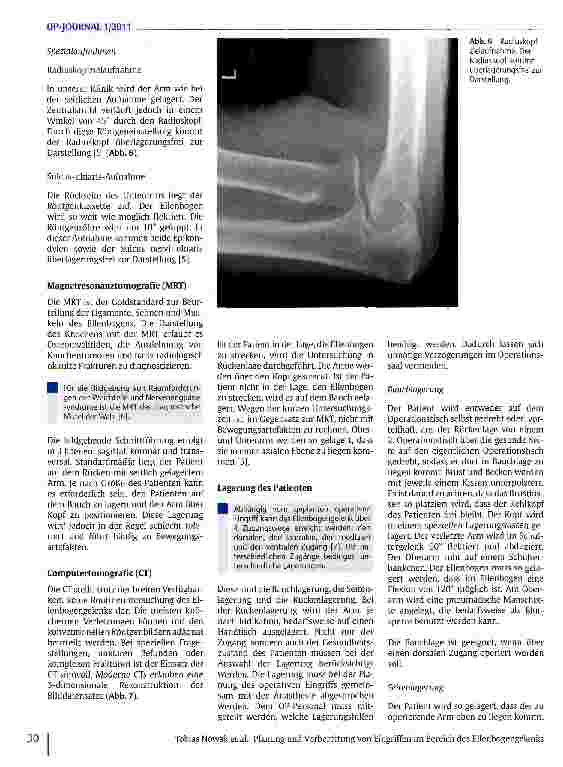 Vorschauseite 5: Planung und Vorbereitung von Eingriffen im Bereich des Ellenbogengelenks