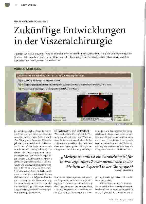 Vorschauseite 1: Zukünftige Entwicklungen in der Viszeralchirurgie