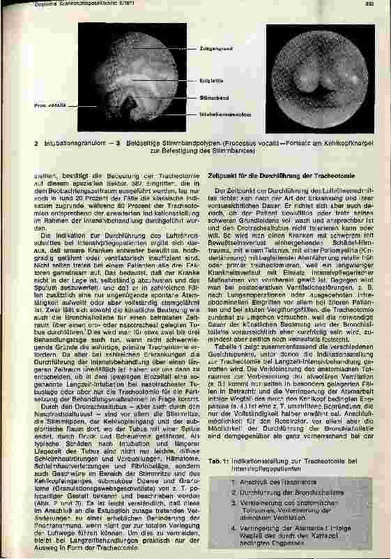 Vorschauseite 2: Die Tracheotomie im Rahmen der Intensivpflege