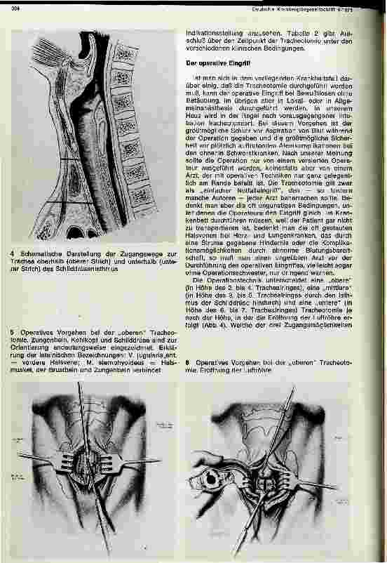 Vorschauseite 3: Die Tracheotomie im Rahmen der Intensivpflege