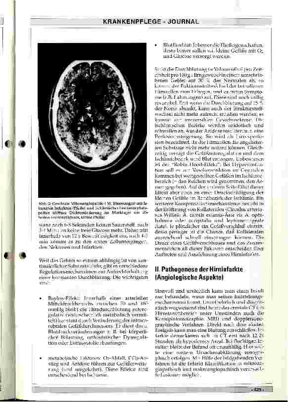 Vorschauseite 2: Pathophysiologie der Hirninfarkte