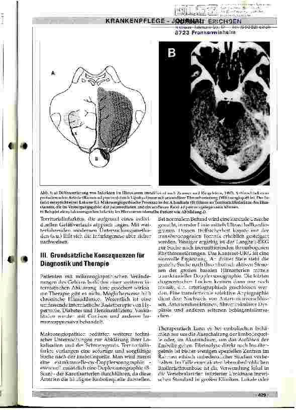 Vorschauseite 6: Pathophysiologie der Hirninfarkte