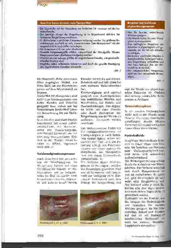 Vorschauseite 3: Moderne Wundversorgung mit Feuchttherapie