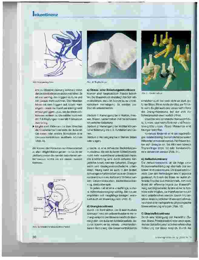 Vorschauseite 4: Vorschlag für die Gestaltung einer Unterrichtseinheit über Blasenfunktionsstörungen