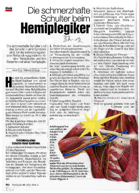 Vorschauseite 1: Die schmerzhafte Schulter beim Hemiplegiker