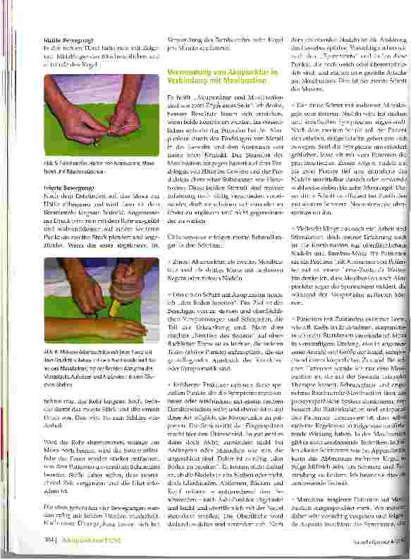 Vorschauseite 3: Bamboo Tube Moxibustion