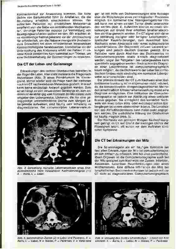 Vorschauseite 2: Die Computertomographie des Oberbauches Bericht aus der Strahlenund Poliklinik Charlottenburg