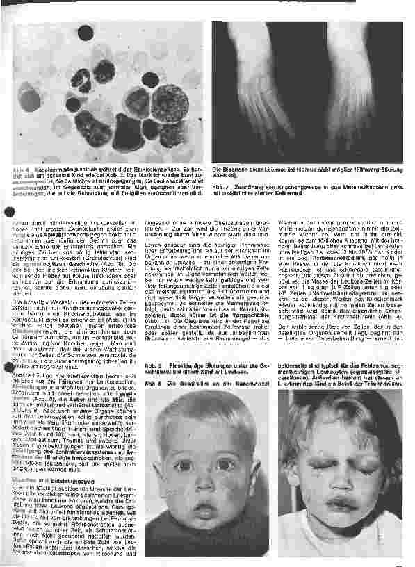 Vorschauseite 2: Kinderheilkunde 28. Folge: Leukosen im Kindesalter