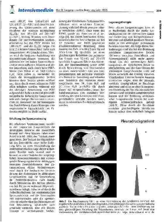 Vorschauseite 3: Lungenprotektive Beatmung beim ARDS