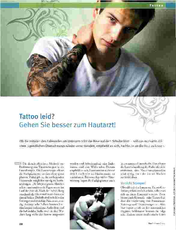 Vorschauseite 1: Tattoo leid? Gehen Sie besser zum Hautarzt!
