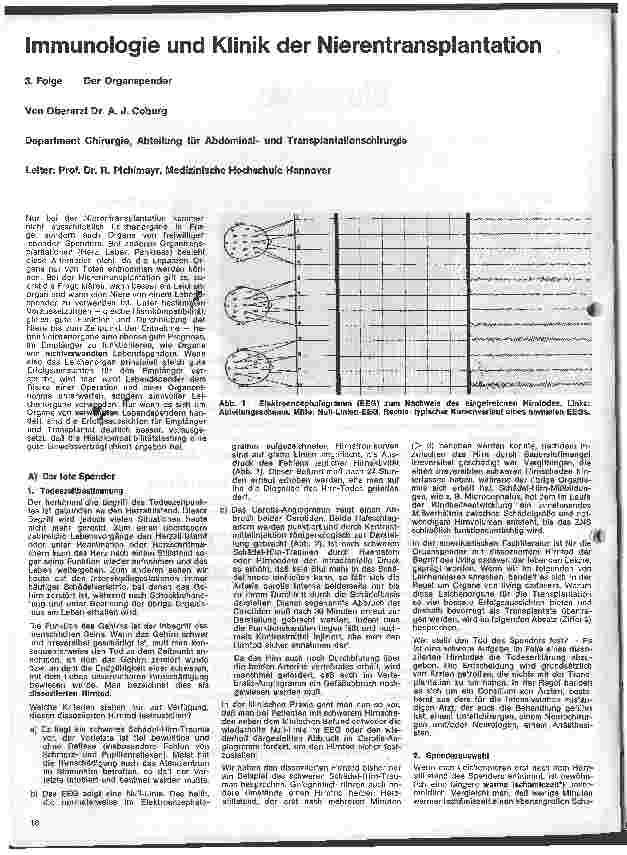 Vorschauseite 1: Immunologie und Klinik der Nierentransplantation 3. Folge: Der Organspender