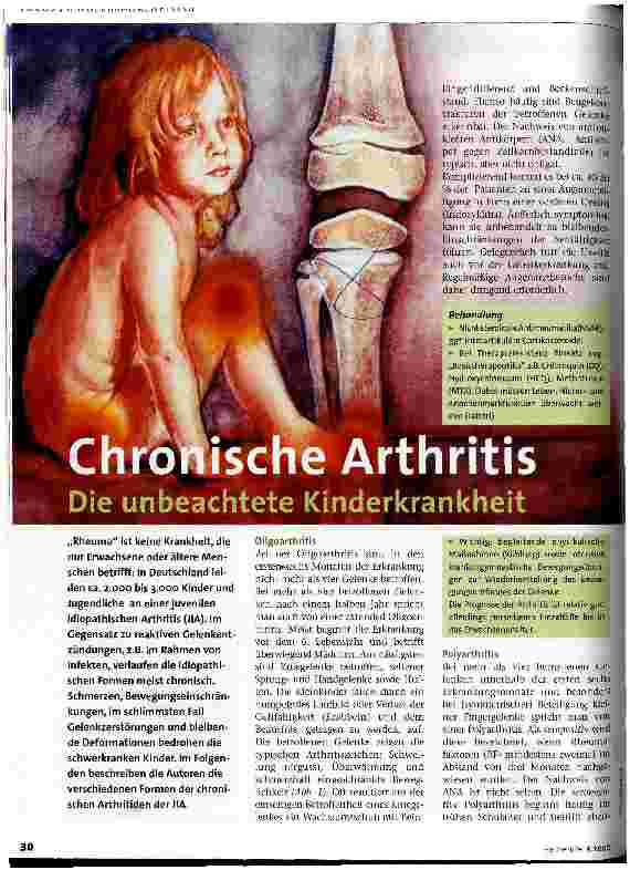 Vorschauseite 1: Chronische Arthritis Die unbeachtete Kinderkrankheit