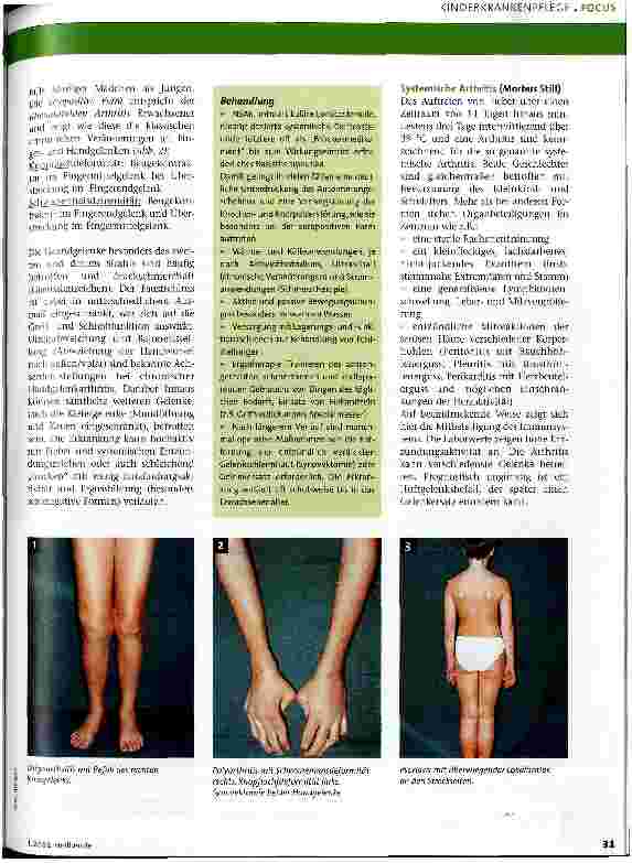 Vorschauseite 2: Chronische Arthritis Die unbeachtete Kinderkrankheit