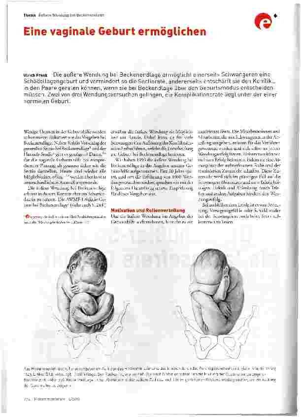 Vorschauseite 1: Eine vaginale Geburt ermöglichen