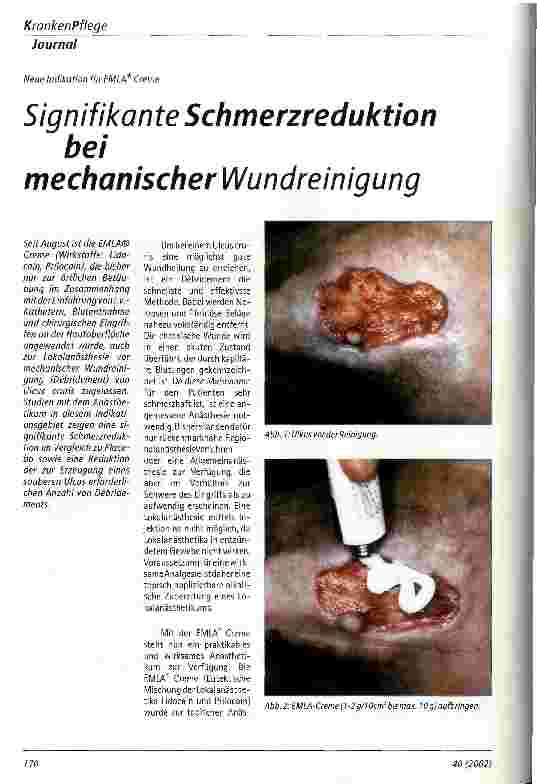 Vorschauseite 1: Signifikante Schmerzreduktion bei mechanischer Wundreinigung Neue Indikation für EMLA Creme