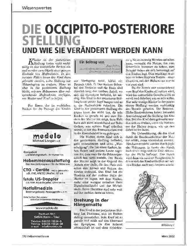 Vorschauseite 1: DIE OCCIPITO-POSTERIORE STELLUNGUND WIE SIE VERÄNDERT WERDEN KANN