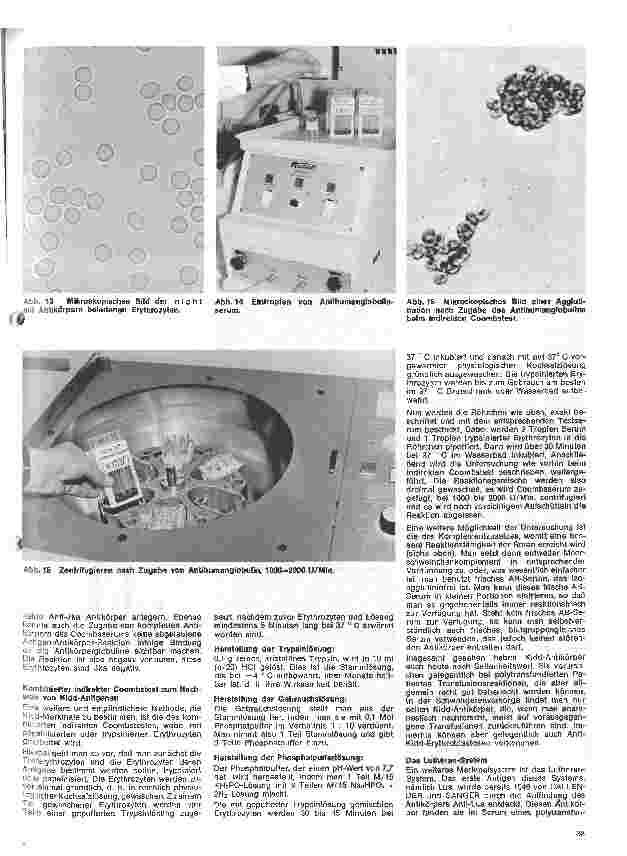 Vorschauseite 4: Transfusionskunde, Blutgruppenserologie und Immunhämatologie 20. Folge: Das Kidd-System