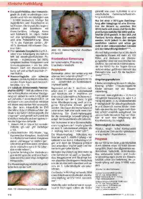 Vorschauseite 4: MASERN* Eliminationsziel 2010 verpasst?