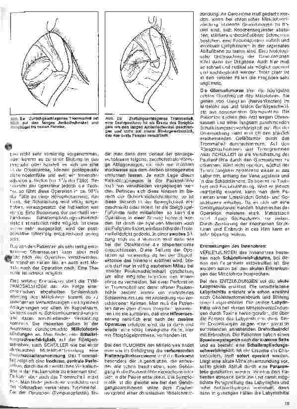 Vorschauseite 2: Einführung in die Hals-Nasen-Ohren-Heilkunde // 6. Folge: Das Ohr: Nichtentzündliche Mittelohrerkrankungen u. Erkrankungen d. Innenohres