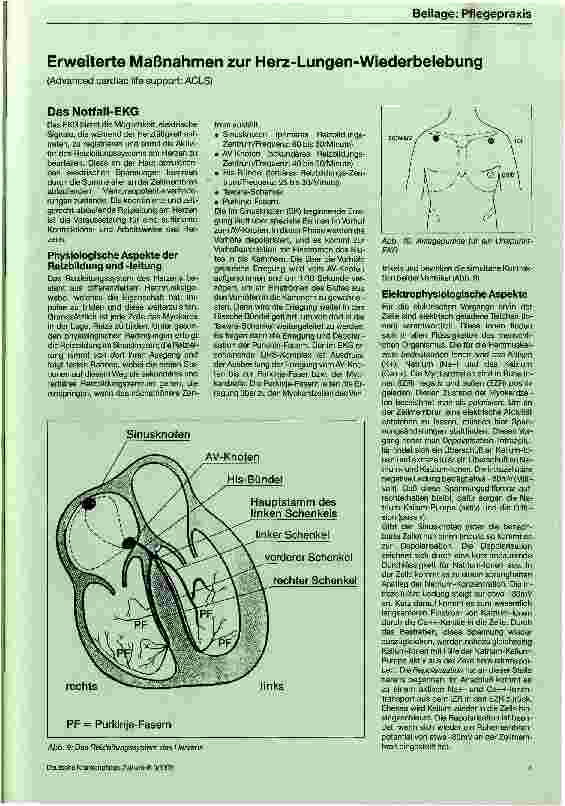Vorschauseite 6: Kardiopulmonale Reanimation Grundlegende(1)+erweiterte(2) Maßnahmen zur Herz-Lungen-Wiederbelebung