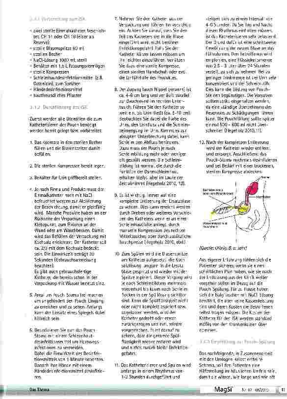 Vorschauseite 2: Erarbeitung eines Pouch- Standards mit Implementierung im Klinikum Neumarkt