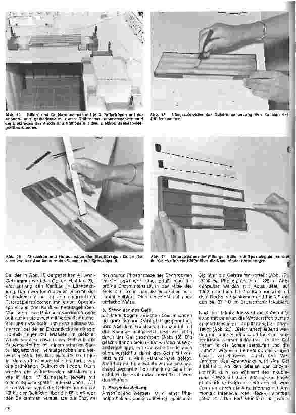 Vorschauseite 5: Transfusionskunde, Blutgruppenserologie, Immunhämatologie 24.Folge: Erbliche Blutmerkmale in den Erythrozyten