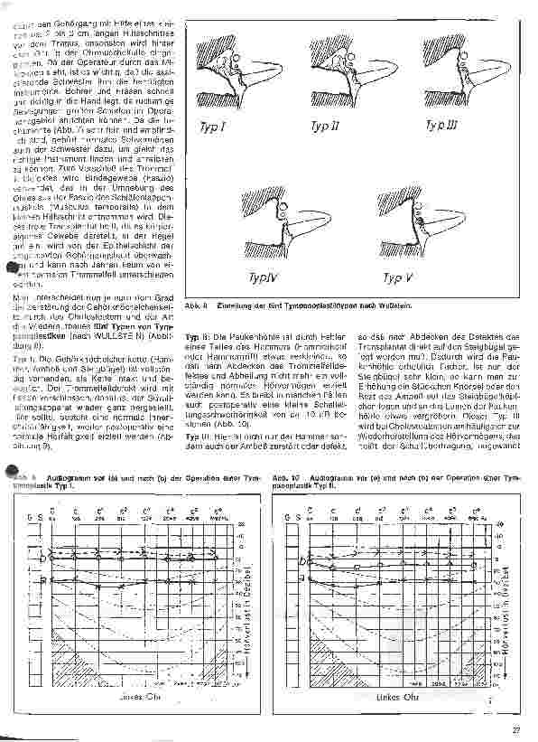 Vorschauseite 4: Einführung in die Hals-Nasen-Ohren-Heilkunde 5.Folge: Das Ohr - Chronische Erkrankungen des Mittelohres