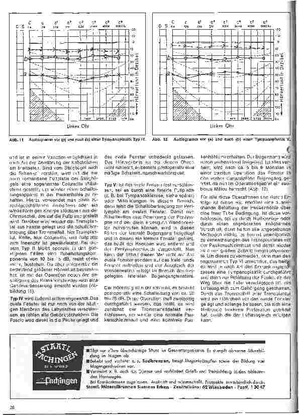 Vorschauseite 5: Einführung in die Hals-Nasen-Ohren-Heilkunde 5.Folge: Das Ohr - Chronische Erkrankungen des Mittelohres