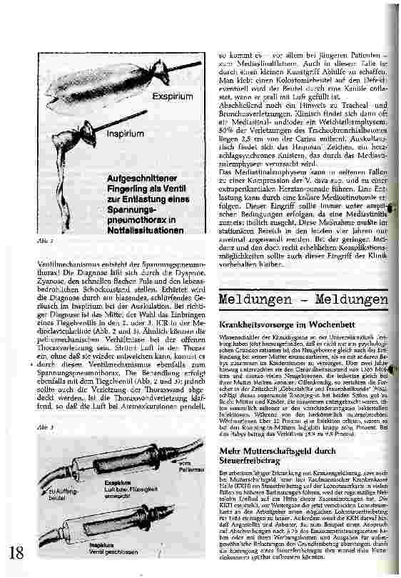 Vorschauseite 2: Das Thoraxtrauma- Klinik und Therapie