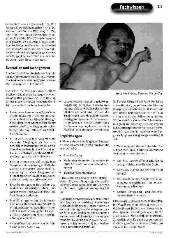 Vorschauseite 4: ABM Klinisches Protokoll Nr. 24: Allergische Proktokolitis beim ausschließlich gestillten Säugling