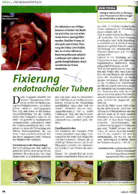 Vorschauseite 1: Fixierung endotrachealer Tuben