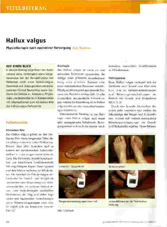 Vorschauseite 1: Hallux valgus