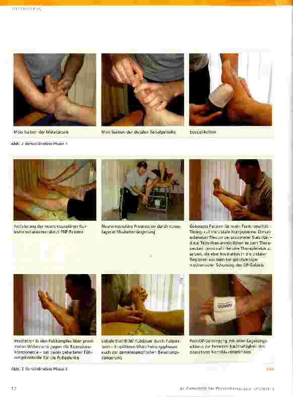 Vorschauseite 3: Hallux valgus