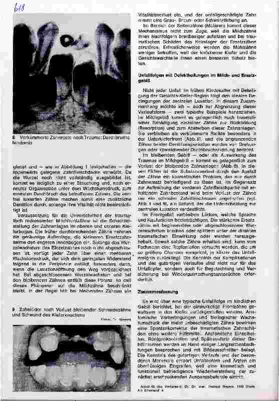 Vorschauseite 4: Gutartige Unfallfolgen im Milchgebiß