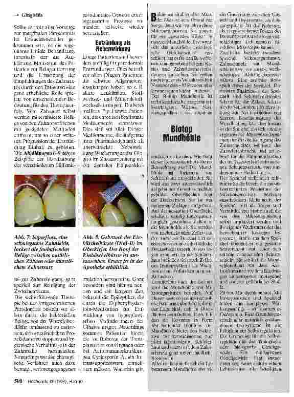 Vorschauseite 3: Gingivitis und Parodontitis Zahnerhaltung durch gezielte Prophylaxe