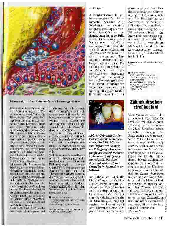 Vorschauseite 4: Gingivitis und Parodontitis Zahnerhaltung durch gezielte Prophylaxe