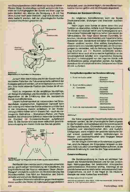 Vorschauseite 2: Möglichkeiten und Probleme der Sondenernährung beim laparotomierten Kind