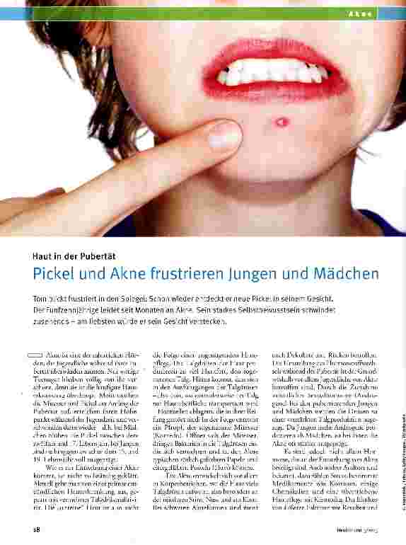 Vorschauseite 1: Pickel und Akne frustrieren Jungen und Mädchen