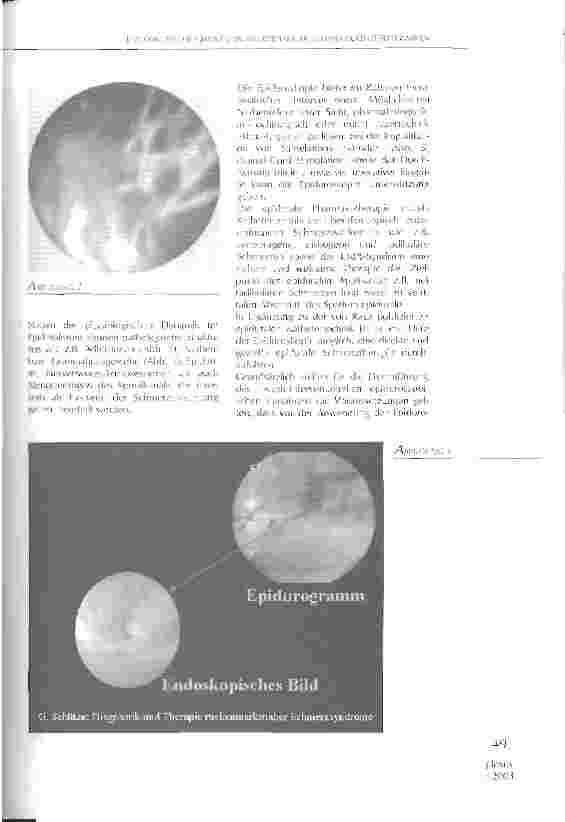 Vorschauseite 2: Endoskopische Objektivierung epiduraler Schmerzkathetertechniken
