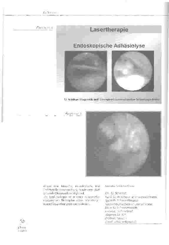 Vorschauseite 3: Endoskopische Objektivierung epiduraler Schmerzkathetertechniken