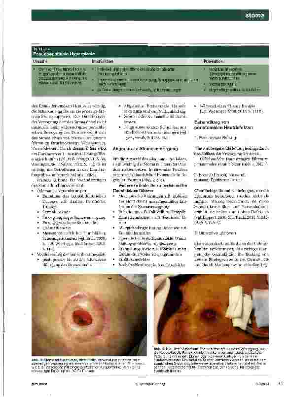 Vorschauseite 4: Peristomale Hautdefekte
