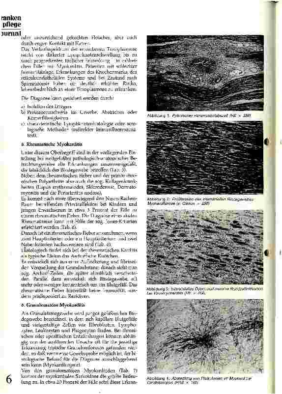 Vorschauseite 3: Ursachen, Klinik und Therapie der Myokarditis