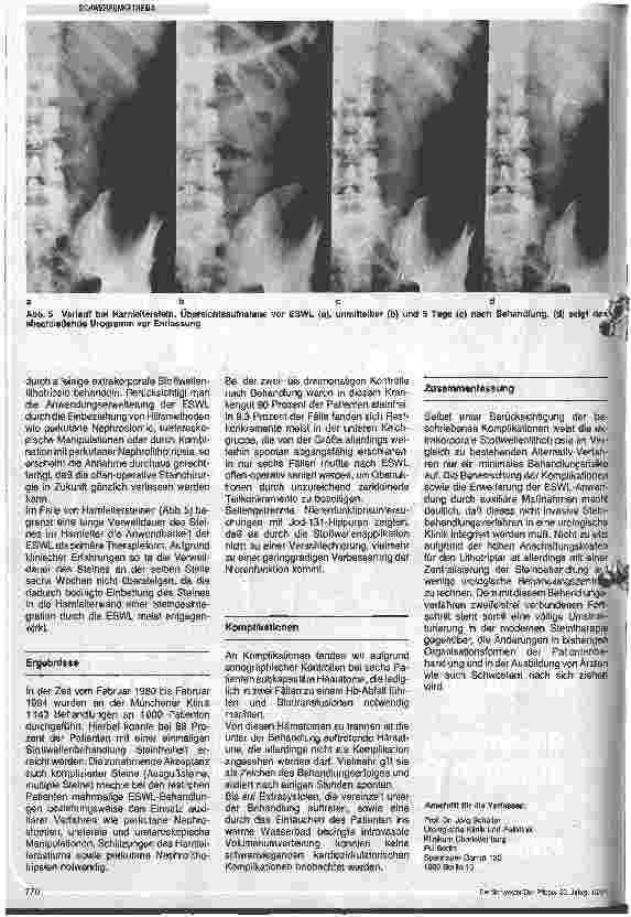 Vorschauseite 3: Die berührungsfreie Nierensteinzertrümmerung eine neue Therapie des Harnsteinleidens