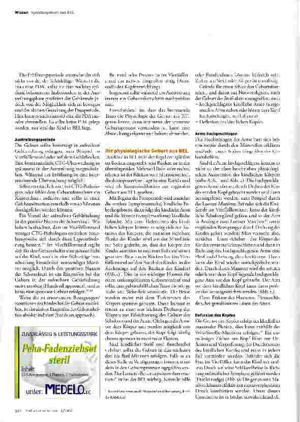 Vorschauseite 3: Beckenendlage - die besondere Geburt