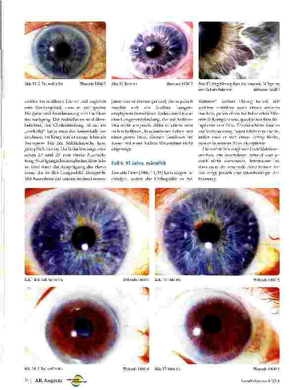 Vorschauseite 4: Über die Iris und die Langlebigkeit