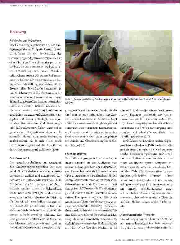 Vorschauseite 2: Akrodynamische Therapie verbessert die Navikularhöhe und mindert den Fußinnenrandwinkel bei Hallux valgus